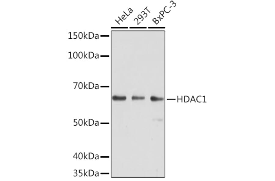 Western Blot - Anti-HDAC1 Antibody [AMC0232] (A308654) - Antibodies.com
