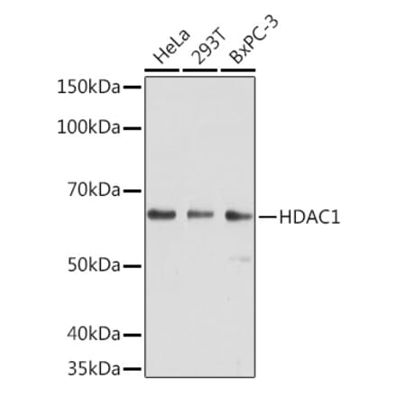Western Blot - Anti-HDAC1 Antibody [AMC0232] (A308654) - Antibodies.com