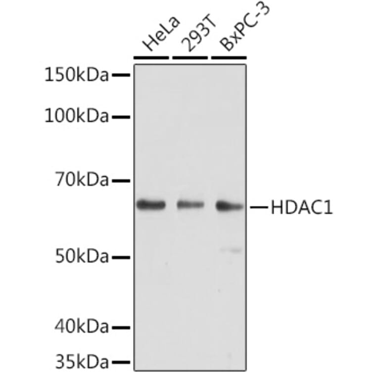 Western Blot - Anti-HDAC1 Antibody [AMC0232] (A308654) - Antibodies.com
