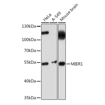 Western Blot - Anti-MIER1 Antibody (A308655) - Antibodies.com