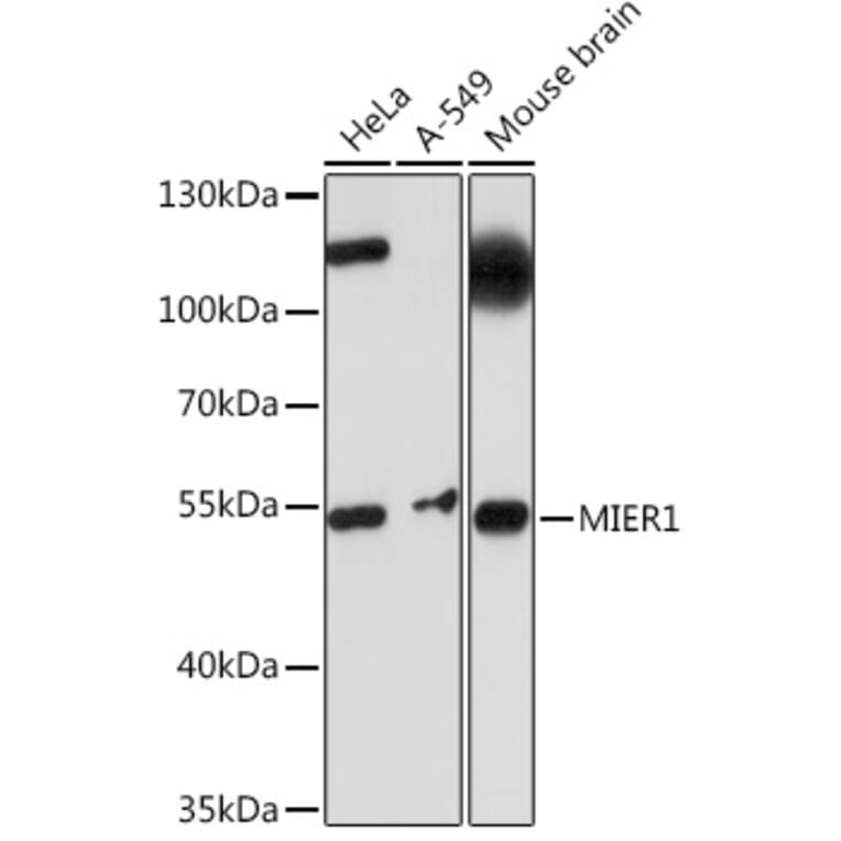 Western Blot - Anti-MIER1 Antibody (A308655) - Antibodies.com