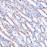 Immunohistochemistry - Anti-MIER1 Antibody (A308655) - Antibodies.com