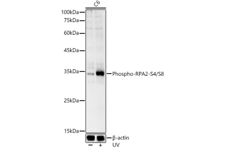 Western Blot - Anti-RPA32/RPA2 (phospho Ser4 + Ser8) Antibody (A308656) - Antibodies.com