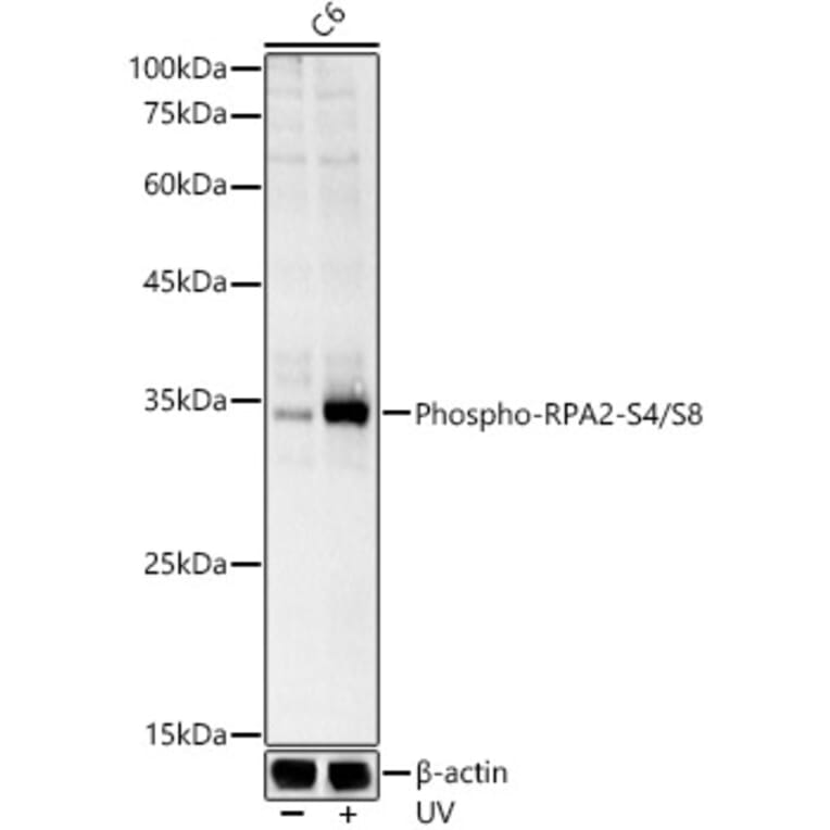 Western Blot - Anti-RPA32/RPA2 (phospho Ser4 + Ser8) Antibody (A308656) - Antibodies.com