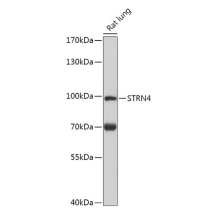 Western Blot - Anti-Striatin 4 Antibody (A308657) - Antibodies.com