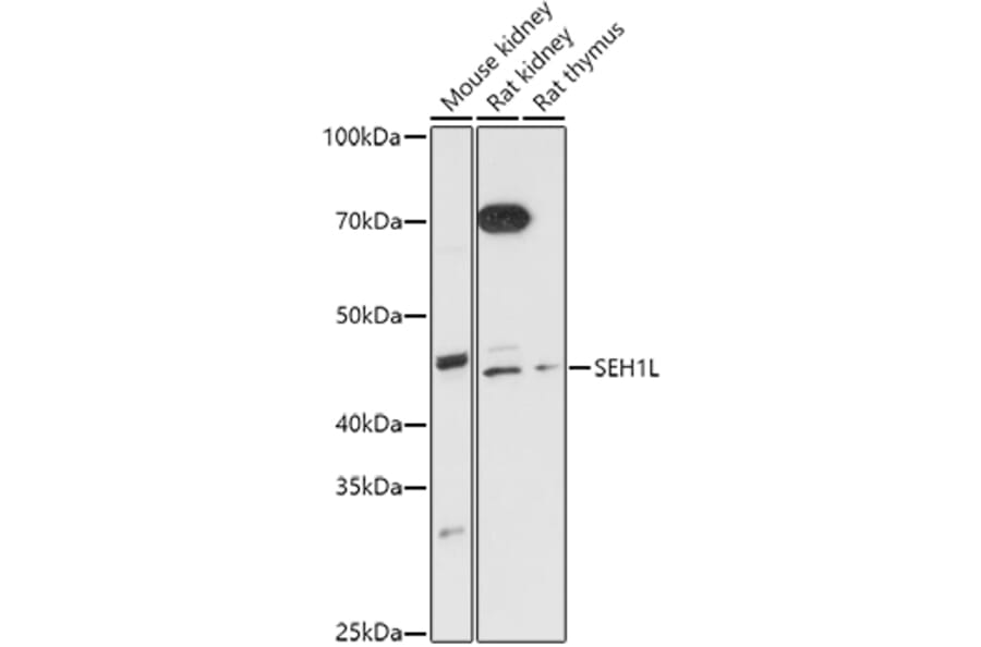 Western Blot - Anti-SEH1L Antibody (A308658) - Antibodies.com
