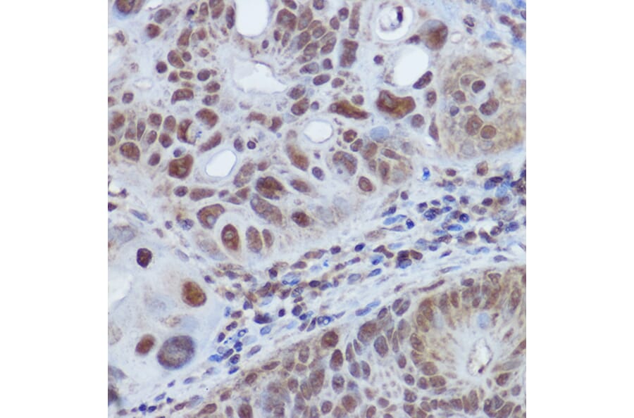 Immunohistochemistry - Anti-RBMY1A1 Antibody (A308659) - Antibodies.com