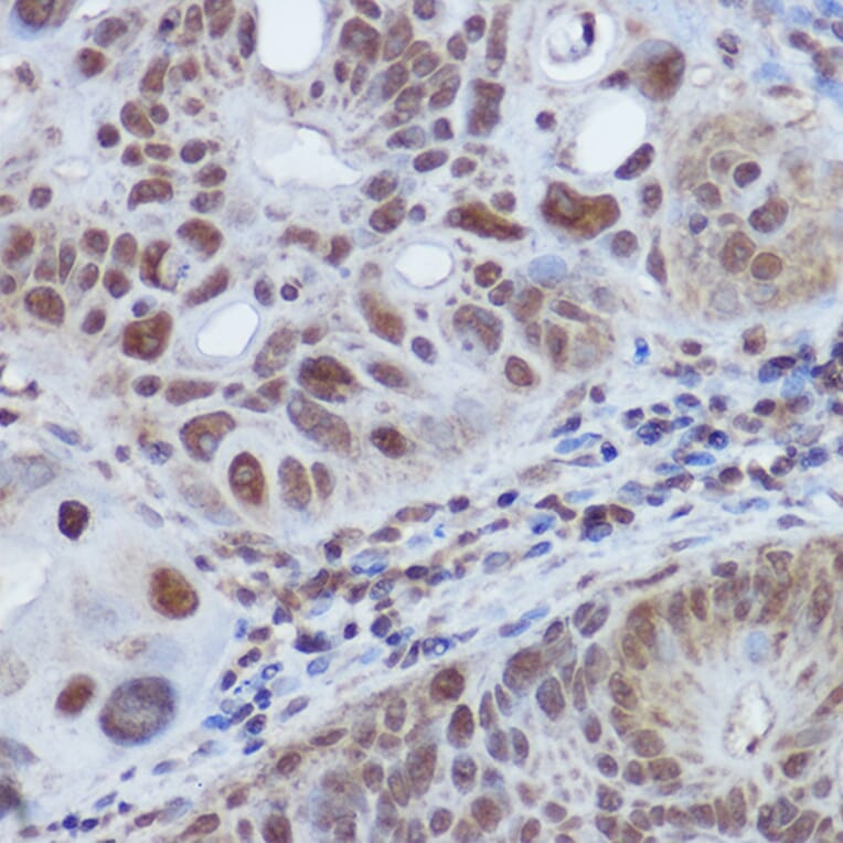 Immunohistochemistry - Anti-RBMY1A1 Antibody (A308659) - Antibodies.com