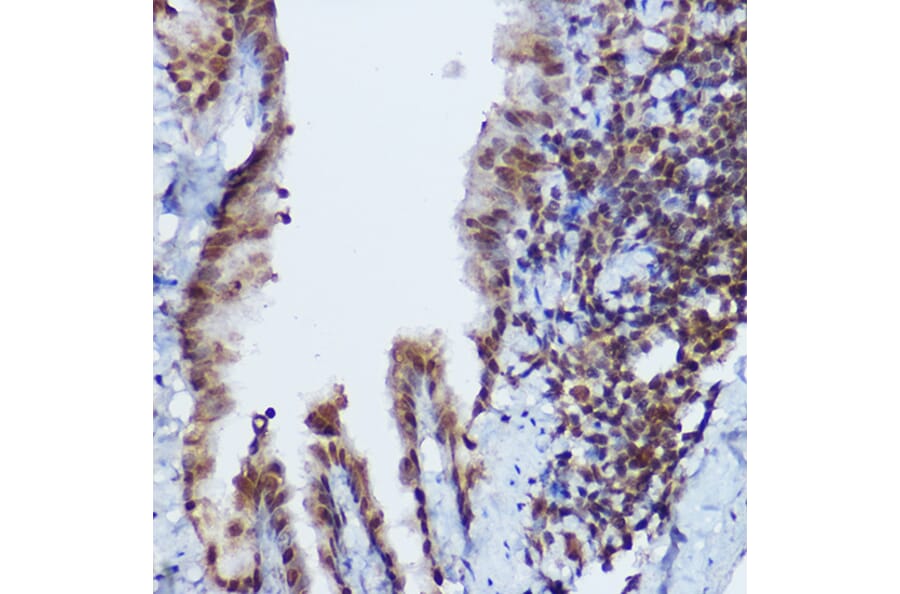 Immunohistochemistry - Anti-RBMY1A1 Antibody (A308659) - Antibodies.com