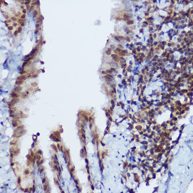 Immunohistochemistry - Anti-RBMY1A1 Antibody (A308659) - Antibodies.com