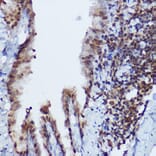 Immunohistochemistry - Anti-RBMY1A1 Antibody (A308659) - Antibodies.com