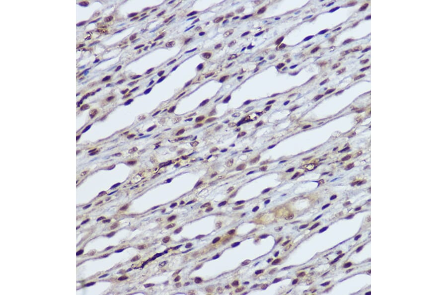 Immunohistochemistry - Anti-RBMY1A1 Antibody (A308659) - Antibodies.com