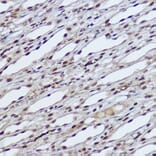 Immunohistochemistry - Anti-RBMY1A1 Antibody (A308659) - Antibodies.com