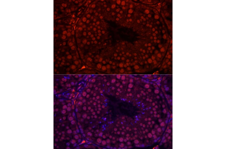 Immunofluorescence - Anti-RBMY1A1 Antibody (A308659) - Antibodies.com