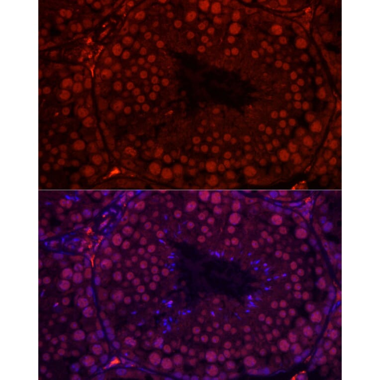 Immunofluorescence - Anti-RBMY1A1 Antibody (A308659) - Antibodies.com