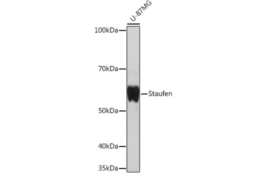 Western Blot - Anti-Staufen/STAU1 Antibody [ARC1054] (A308660) - Antibodies.com