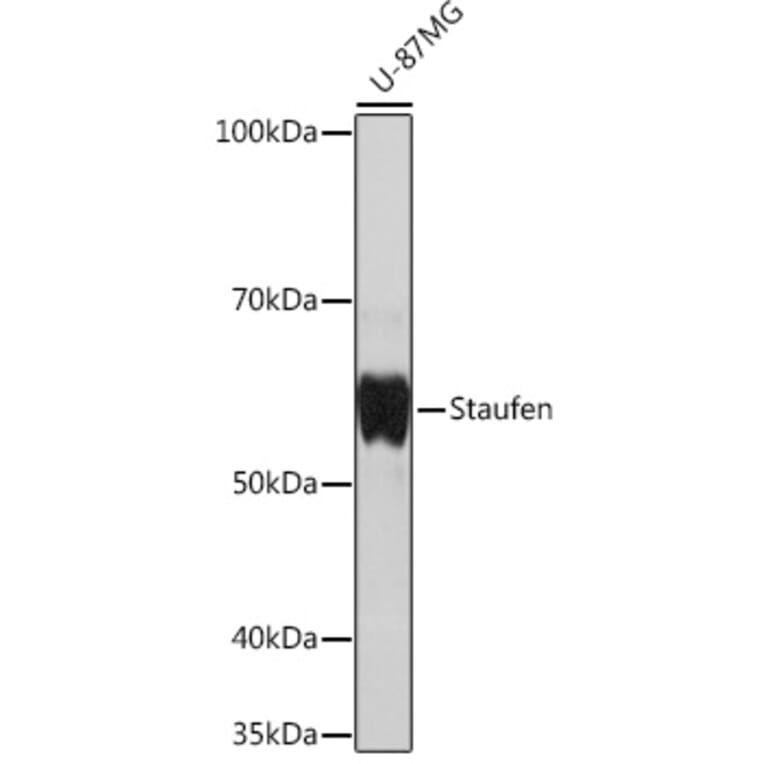 Western Blot - Anti-Staufen/STAU1 Antibody [ARC1054] (A308660) - Antibodies.com