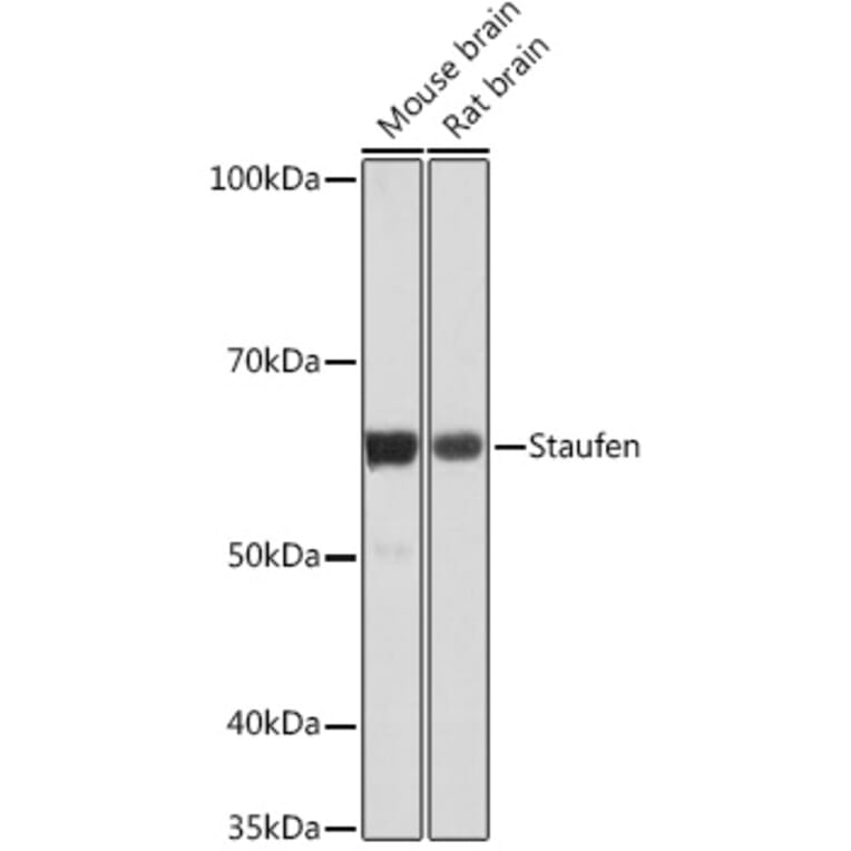 Western Blot - Anti-Staufen/STAU1 Antibody [ARC1054] (A308660) - Antibodies.com