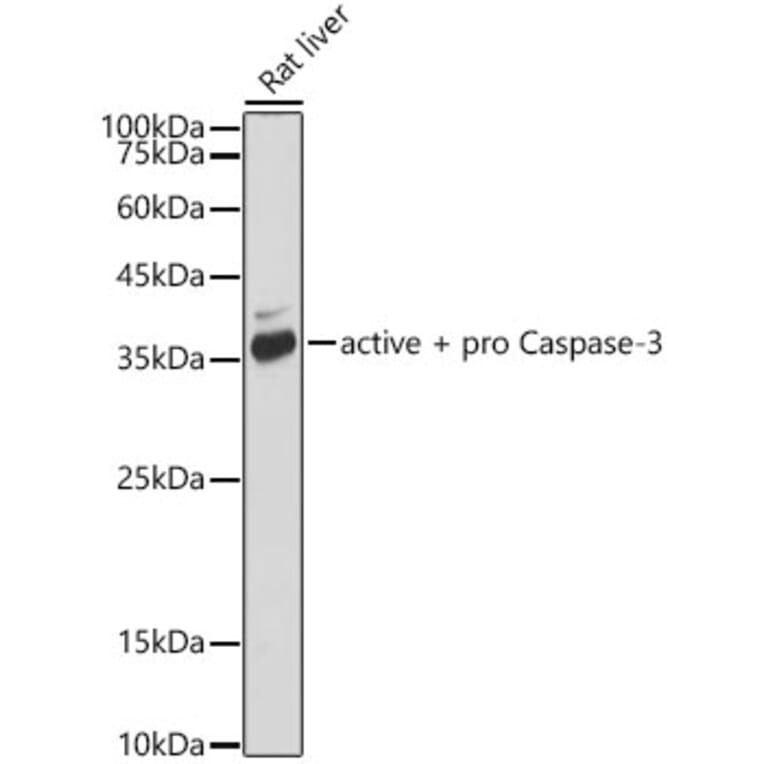 Western Blot - Anti-Caspase-3 Antibody [ARC0133] (A308661) - Antibodies.com