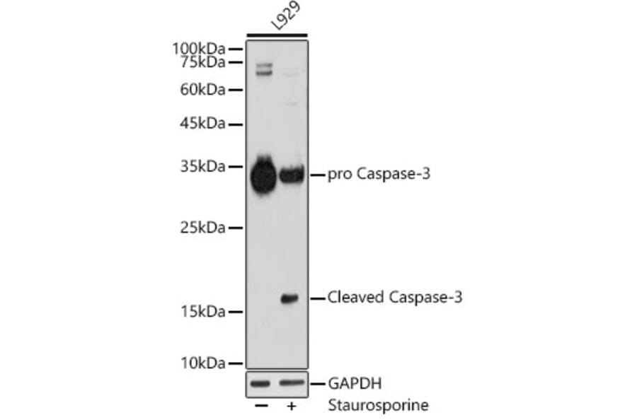 Western Blot - Anti-Caspase-3 Antibody [ARC0133] (A308661) - Antibodies.com