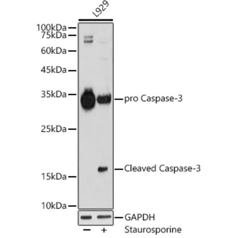 Western Blot - Anti-Caspase-3 Antibody [ARC0133] (A308661) - Antibodies.com