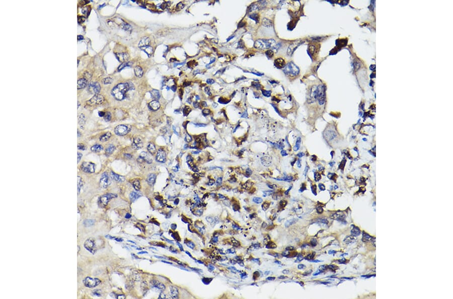 Immunohistochemistry - Anti-Caspase-3 Antibody (A308662) - Antibodies.com