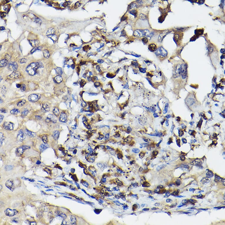 Immunohistochemistry - Anti-Caspase-3 Antibody (A308662) - Antibodies.com