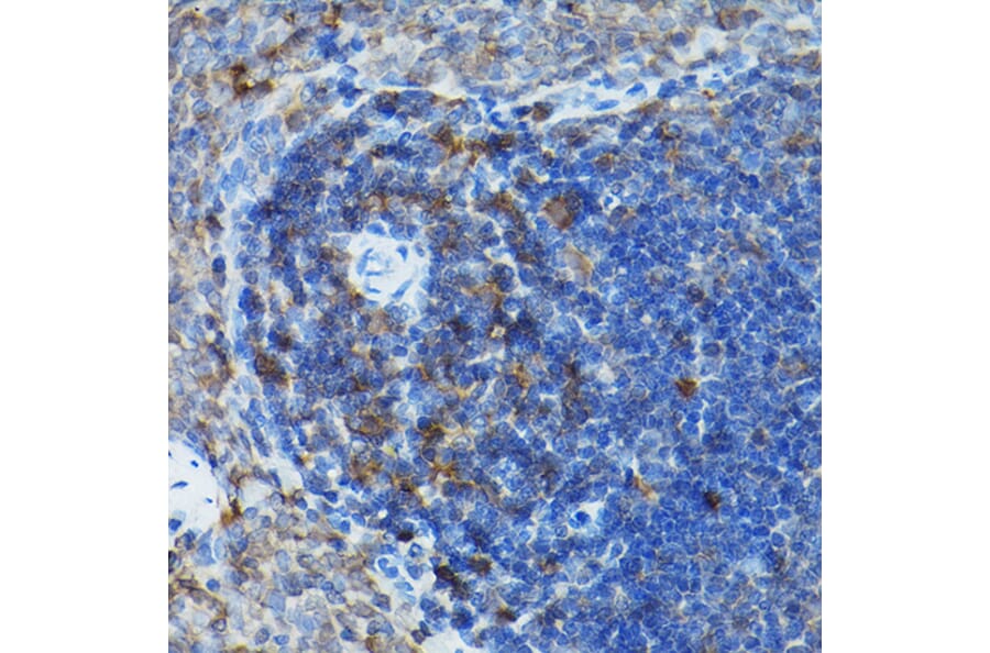 Immunohistochemistry - Anti-Caspase-3 Antibody (A308662) - Antibodies.com