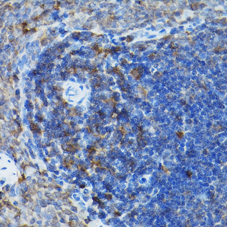 Immunohistochemistry - Anti-Caspase-3 Antibody (A308662) - Antibodies.com