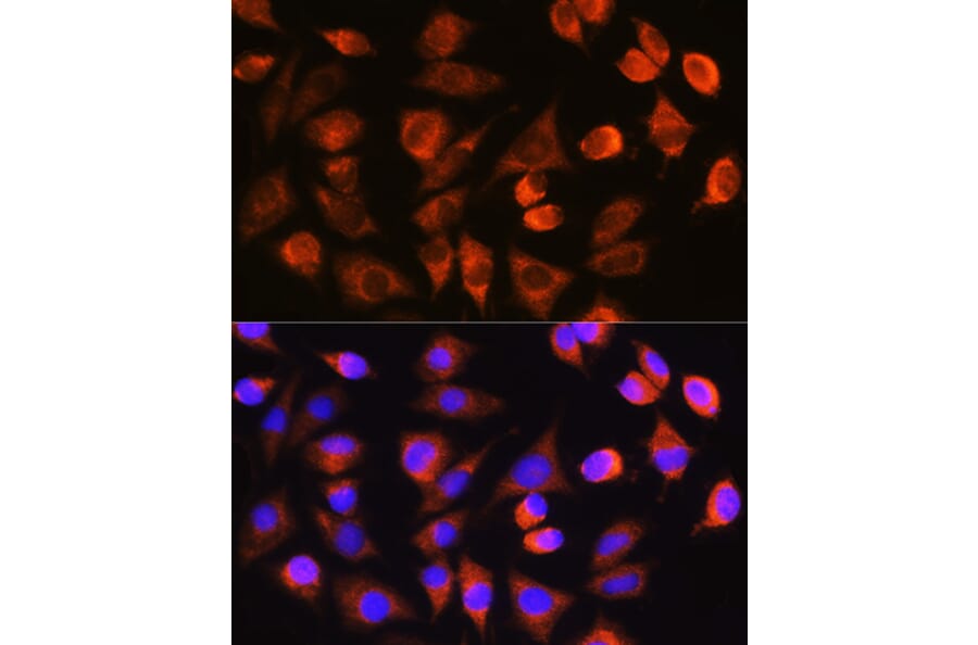 Immunofluorescence - Anti-Caspase-3 Antibody (A308662) - Antibodies.com