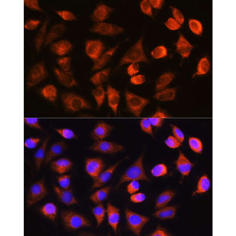 Immunofluorescence - Anti-Caspase-3 Antibody (A308662) - Antibodies.com