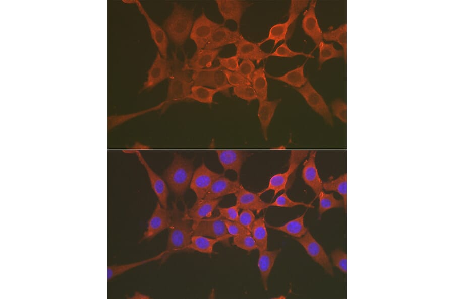 Immunofluorescence - Anti-Caspase-3 Antibody (A308662) - Antibodies.com