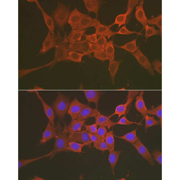 Immunofluorescence - Anti-Caspase-3 Antibody (A308662) - Antibodies.com