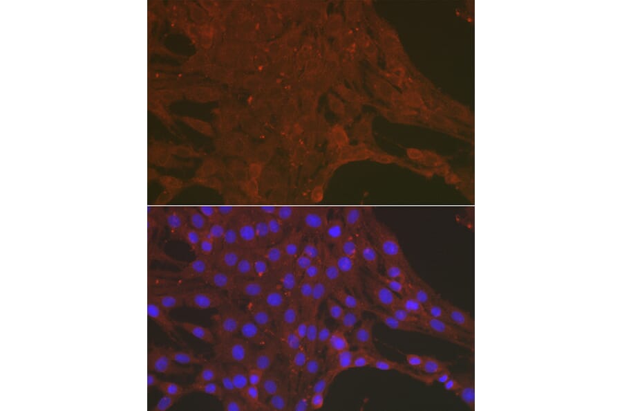 Immunofluorescence - Anti-Caspase-3 Antibody (A308662) - Antibodies.com