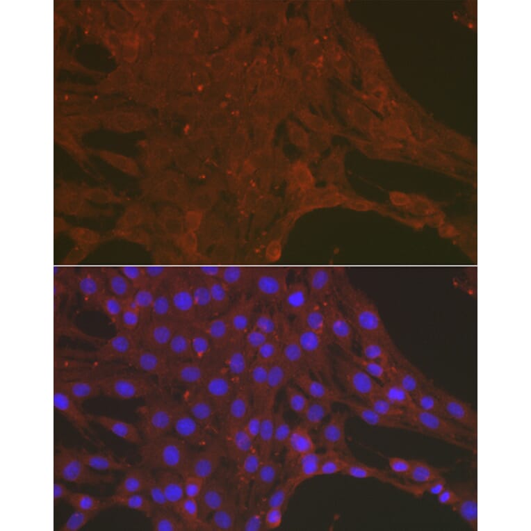Immunofluorescence - Anti-Caspase-3 Antibody (A308662) - Antibodies.com