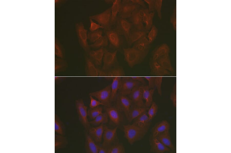 Immunofluorescence - Anti-Caspase-3 Antibody (A308662) - Antibodies.com