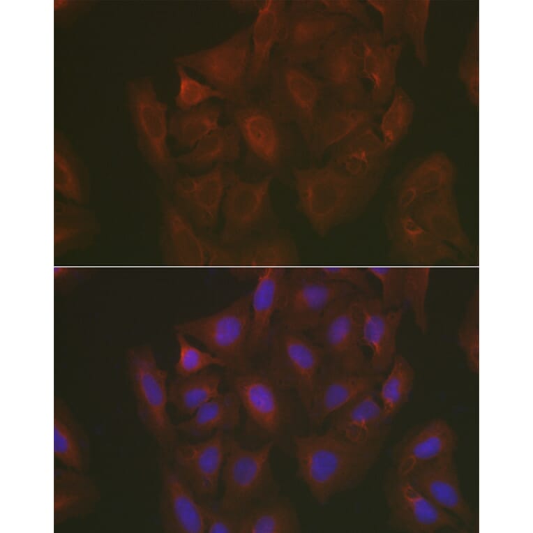 Immunofluorescence - Anti-Caspase-3 Antibody (A308662) - Antibodies.com