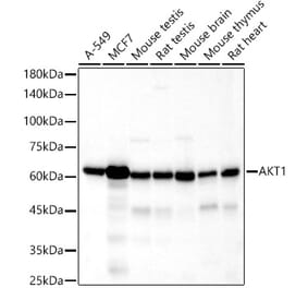 Western Blot - Anti-AKT1 Antibody [ARC51585] (A308667) - Antibodies.com