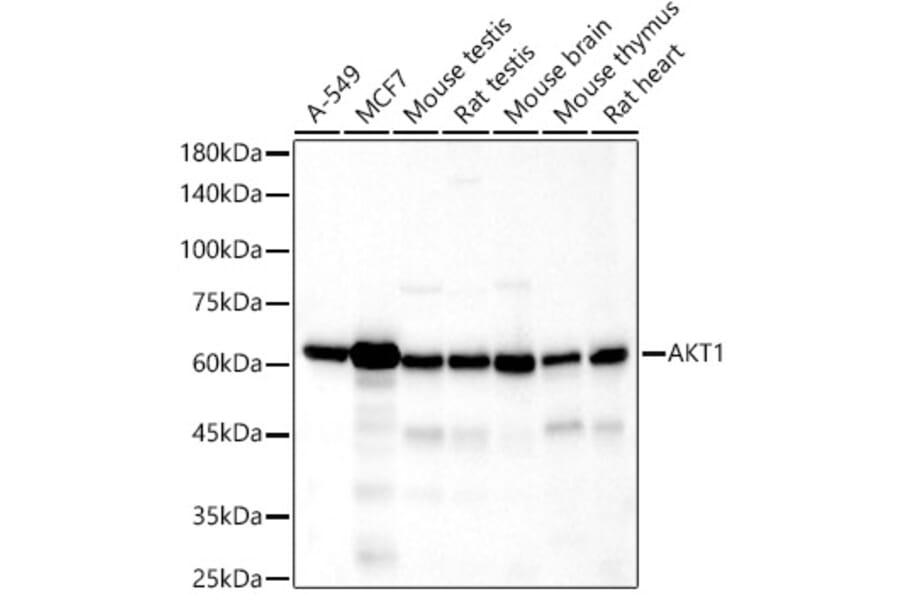 Western Blot - Anti-AKT1 Antibody [ARC51585] (A308667) - Antibodies.com