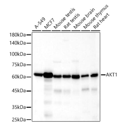 Western Blot - Anti-AKT1 Antibody [ARC51585] (A308667) - Antibodies.com