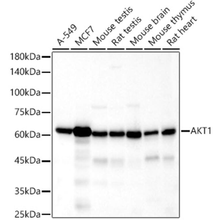 Western Blot - Anti-AKT1 Antibody [ARC51585] (A308667) - Antibodies.com