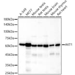 Western Blot - Anti-AKT1 Antibody [ARC51585] (A308667) - Antibodies.com