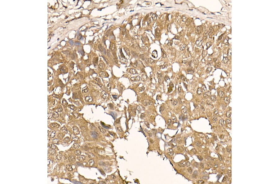 Immunohistochemistry - Anti-AKT1 Antibody [ARC51585] (A308667) - Antibodies.com