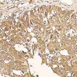 Immunohistochemistry - Anti-AKT1 Antibody [ARC51585] (A308667) - Antibodies.com