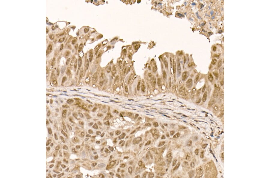 Immunohistochemistry - Anti-AKT1 Antibody [ARC51585] (A308667) - Antibodies.com