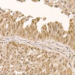 Immunohistochemistry - Anti-AKT1 Antibody [ARC51585] (A308667) - Antibodies.com