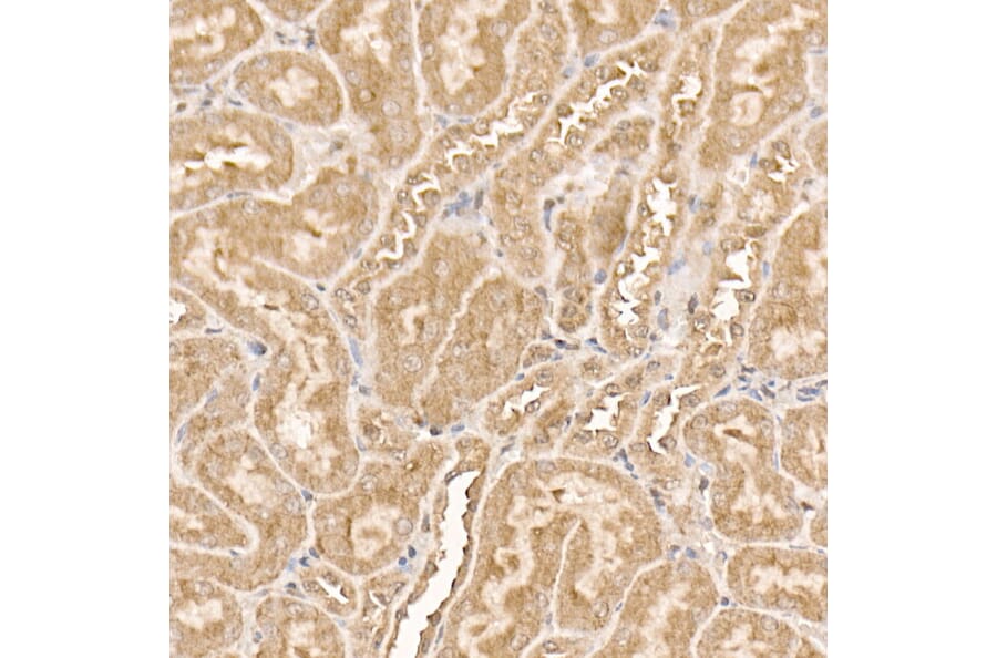 Immunohistochemistry - Anti-AKT1 Antibody [ARC51585] (A308667) - Antibodies.com