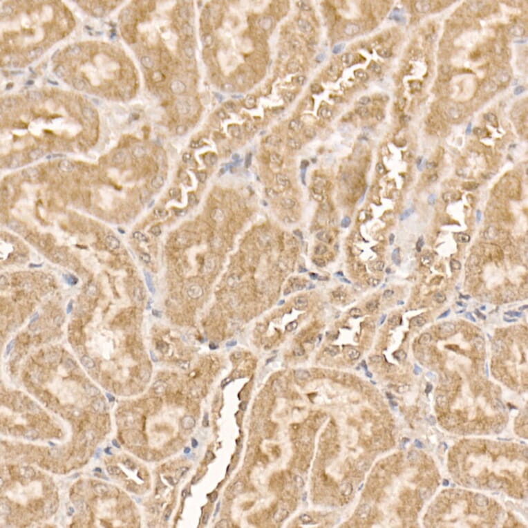 Immunohistochemistry - Anti-AKT1 Antibody [ARC51585] (A308667) - Antibodies.com