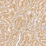 Immunohistochemistry - Anti-AKT1 Antibody [ARC51585] (A308667) - Antibodies.com