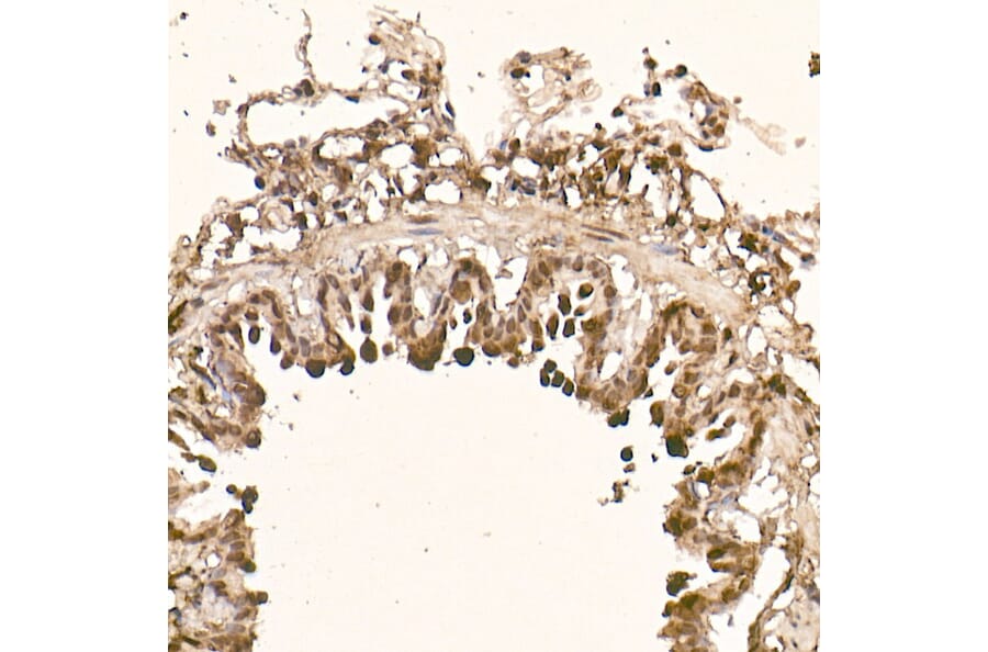 Immunohistochemistry - Anti-AKT1 Antibody [ARC51585] (A308667) - Antibodies.com